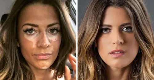 Un nuovo trattamento potrebbe essere una 