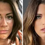 Un nuovo trattamento potrebbe essere una 