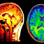 Possono le scansioni cerebrali rivelare chi sono i vostri amici?
