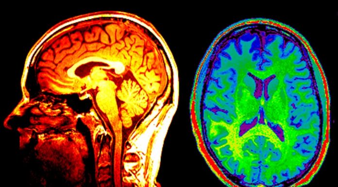 Possono le scansioni cerebrali rivelare chi sono i vostri amici?